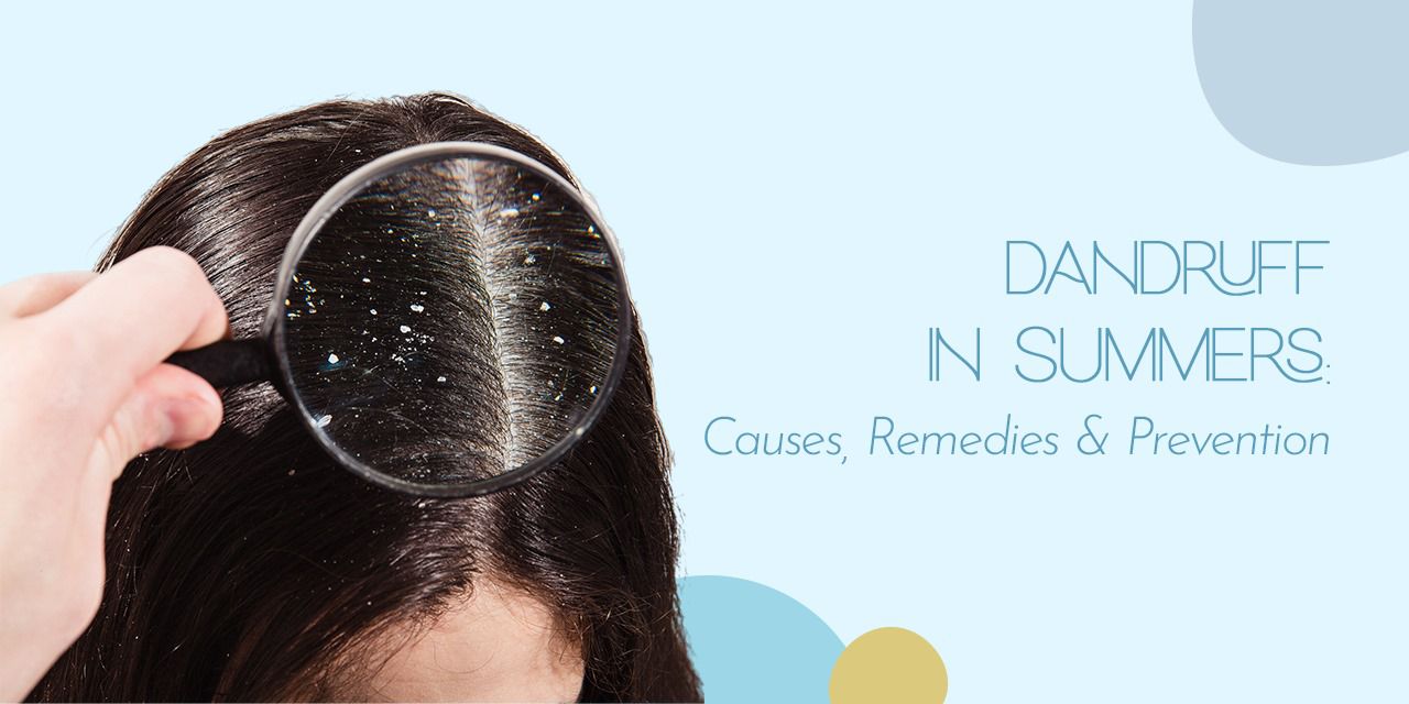 Dandruff In Summers: Causes, Remedies & Prevention